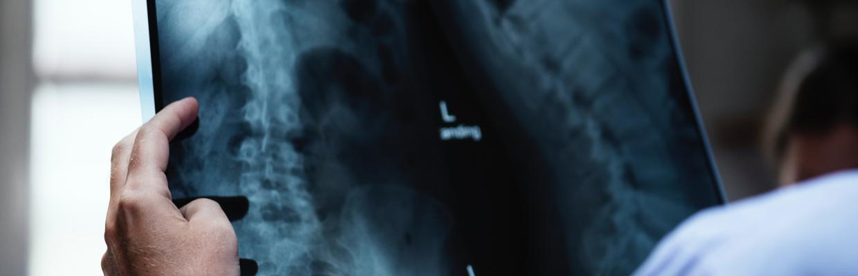 Radiologo verifica una radiografia della colonna vertebrale