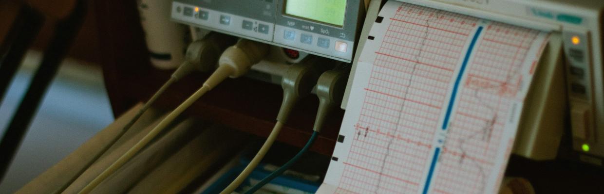 Elettrocardiogramma: risultati